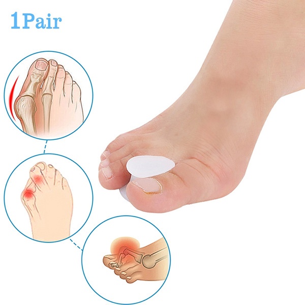 Dụng cụ silicone tách ngón chân cái giảm đau