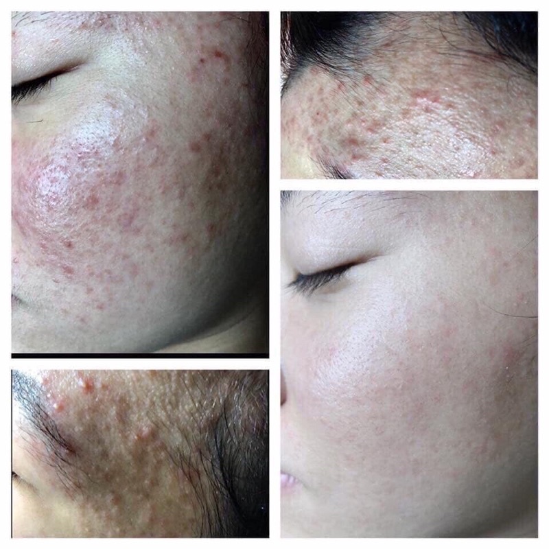 KEM TÁI TẠO DA ĐÔNG Y | BigBuy360 - bigbuy360.vn