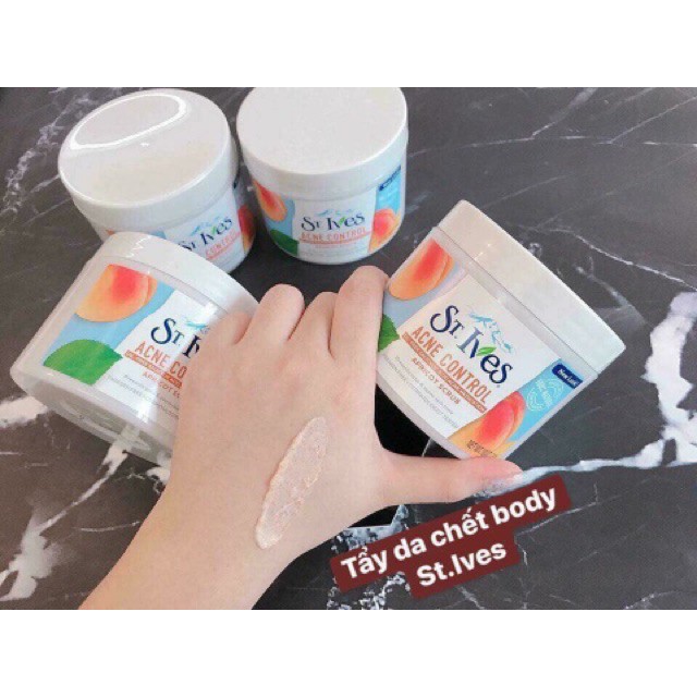 [CHÍNH HÃNG]Tẩy Tế Bào Chết Body St.Ives 283g (Dạng Hũ) | BigBuy360 - bigbuy360.vn