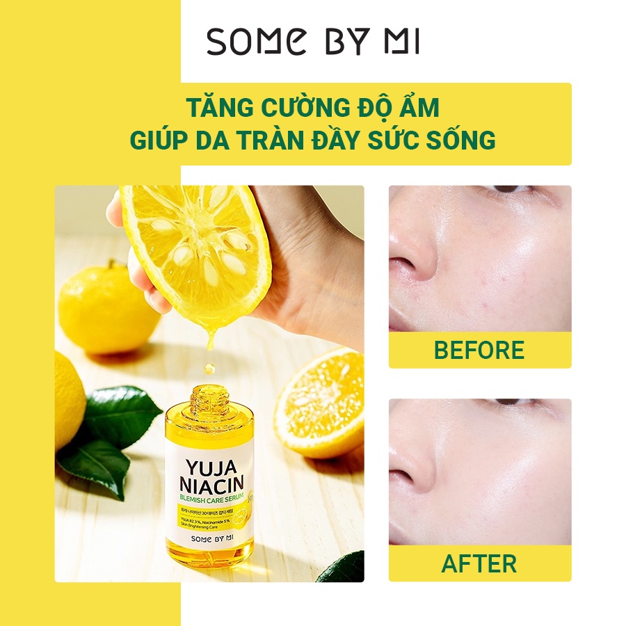 Tinh chất dưỡng trắng Some by Mi Yuja Niacin Blemish Care Serum