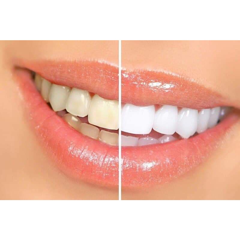 KEM ĐÁNH RĂNG CLOSEUP, COLGATE THÁI LAN 160 GRAM