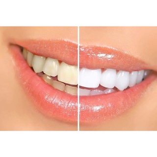 KEM ĐÁNH RĂNG CLOSEUP, COLGATE THÁI LAN 160 GRAM