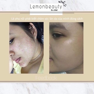 COMBO LEMONMASK KHỔ QUA RỪNG ( MUA 1 TẶNG 3 )