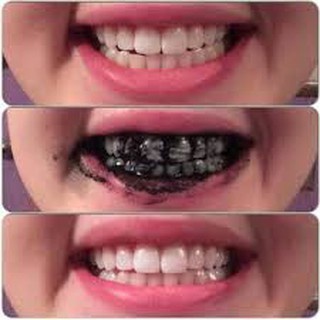 Bột Than Tre Hoạt Tính Làm Trắng Răng