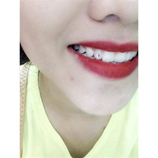 Đá đính răng kim cương nhân tạo
