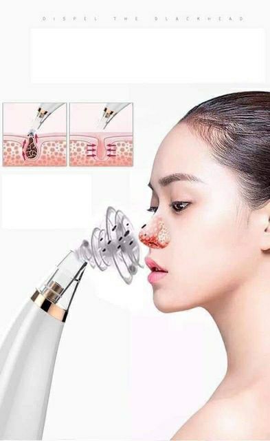 Máy hút mụn cám, Mụn đầu đen siêu sạch