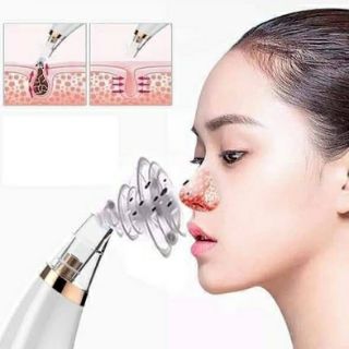 Máy hút mụn cám, Mụn đầu đen siêu sạch
