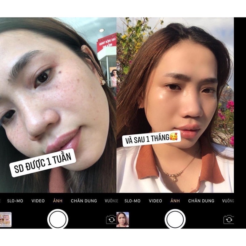 Combo Kem Face Cốt Nám Đông Y Nicos- Kem Face Nicos Cốt Trắng Căng Bóng Nâng Cơ