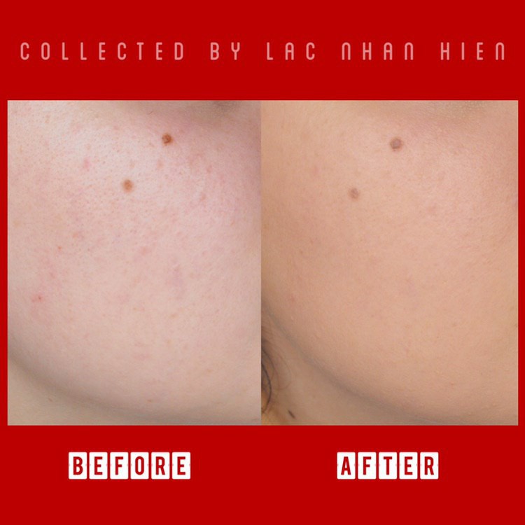 KEM NỀN LA ROCHE-POSAY DẠNG KEM NƯỚC CHO DA THIÊN KHÔ ❤ LA ROCHE-POSAY TOLERIANE FOND DE TEINT CREME | BigBuy360 - bigbuy360.vn