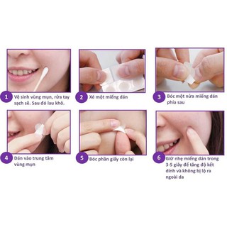 Miếng dán mụn Cosrx Clear Fit Master Patch (màu đen)