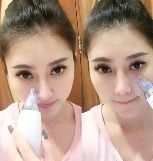 máy hút nhân mụn black head detector
