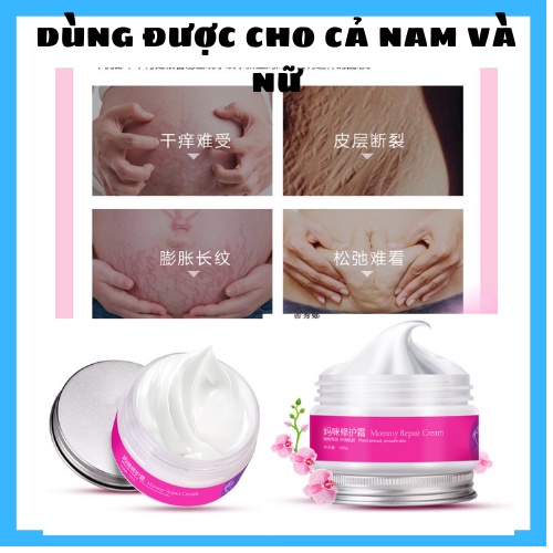 ( MUA 1 TẶNG KÈM 3 SP) Kem phục hồi rạn da,ngừa rạn da Mommy 100G kem 100% thảo dược dùng cho nam nữ cho mọi loại da