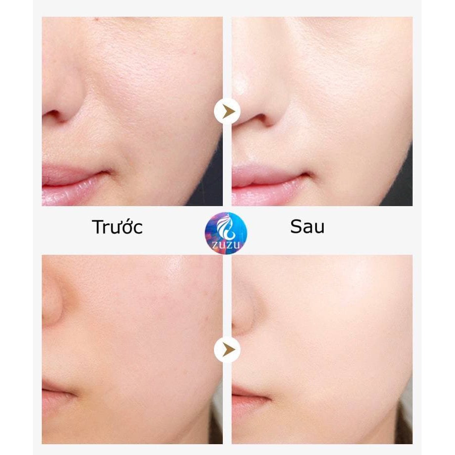 HŨ 120G GEL BHA/ SALYCILYC đắp mặt làm sạch các tế bào chết dư thừa trên da, tan dầu thừa, loại bỏ mụn ẩn, mụn đầu đen