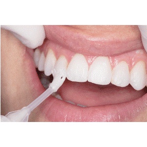 [Dạng ống 1.2 ml] Vecni flour viền đỏ Enamelast chống sâu răng cho trẻ em và người lớn, giảm ê buốt cho răng người lớn