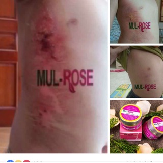 Kem nghệ đa năng trị tất cả các bệnh về da mul rose