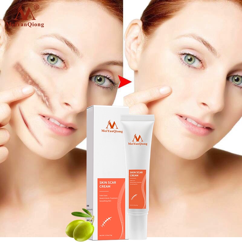 MeiYanQiong Acne Scar Removal Cream Skin Repair Stretch Marks giảm sẹo lồi, lõm, sẹo thâm, do mụn giúp phục hồi các tổn thương trên da thúc đẩy tái tạo da 15ml