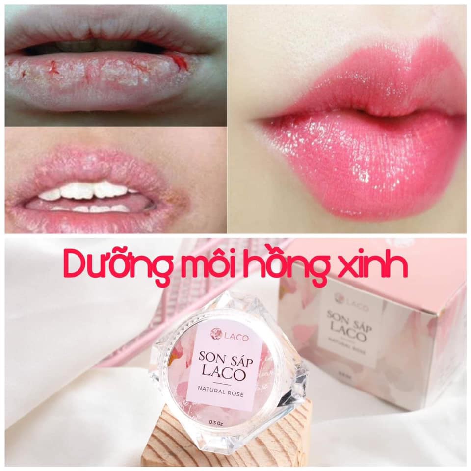 Son Dưỡng Môi 💝FREESHIP💝 Son Dưỡng Organic Tẩy Da Chết Môi Làm Hồng Môi - Son Sáp Laco Chiết Xuất 100% Organic | BigBuy360 - bigbuy360.vn