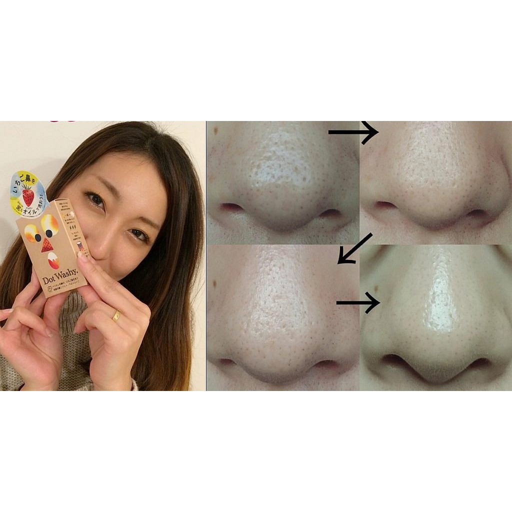 Xà phòng làm giảm mụn đầu đen Dot Washy Facial Social - Nhật Bản