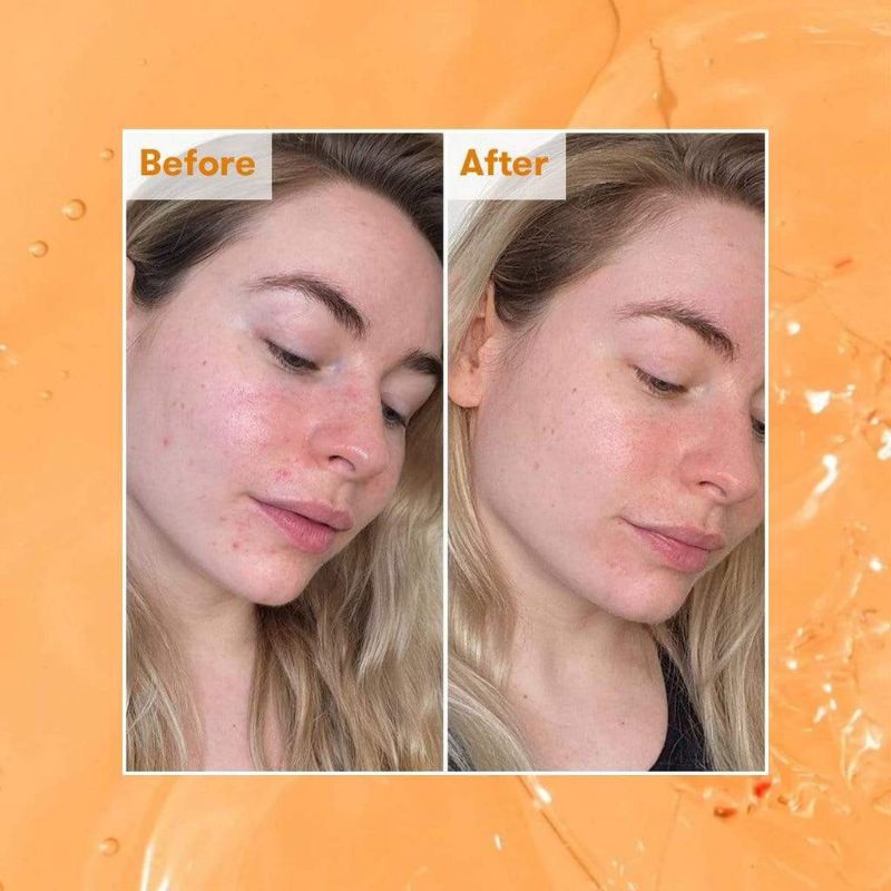 Toner  REN Ready Steady Glow AHA Tonic  làm sáng, cân bằng và dưỡng ẩm