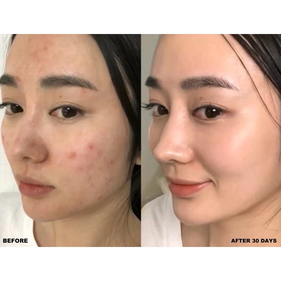 Dung Dịch Loại Bỏ Tế Bào Chết - Paula's Choice Skin Perfecting 2% BHA Liquid Exfoliant 30ml