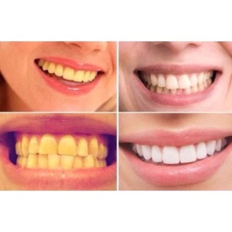 Nước súc miệng Propolinse Nhật Bản giúp làm sạch và giảm mảng bám 600ml