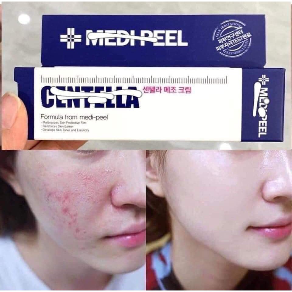 (Sẵn đủ bill) Kem chống mụn Centella Medipeel