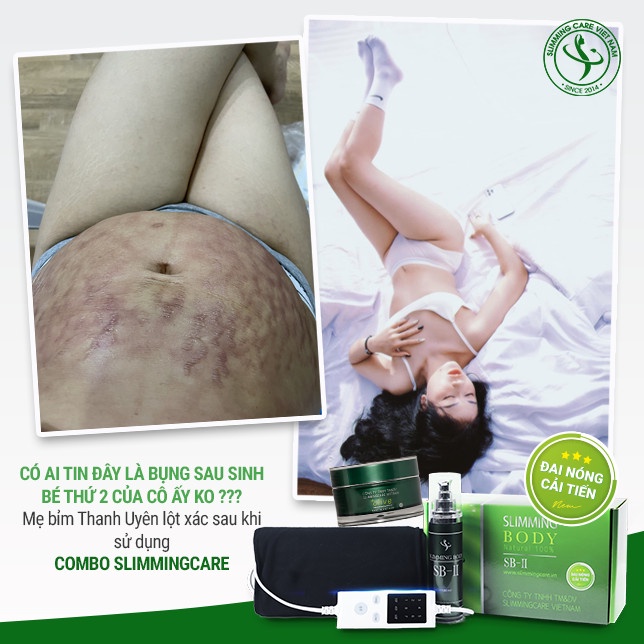 Bộ ủ nóng tan mỡ Slimming Body 2, slimming body sb ii Mit Beauty giúp đào thải mỡ thừa định hình eo thon gọn