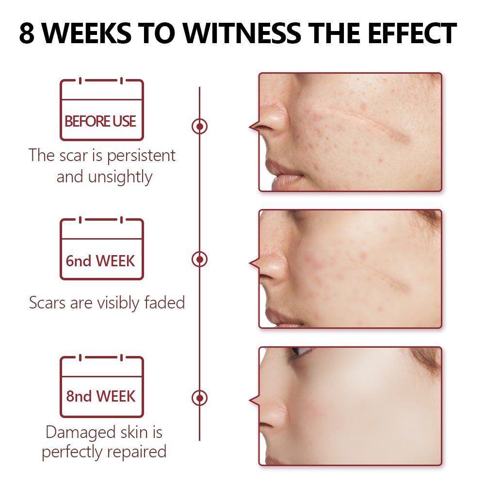 Tinh chất hỗ trợ giảm sẹo VIBRANT GLAMOUR chứa ceramide giúp dưỡng ẩm và trẻ hóa làn da 30ml