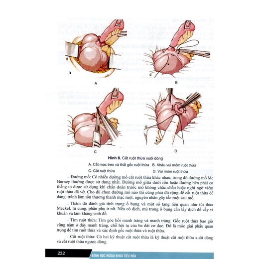 Sách - Bệnh học ngoại khoa tiêu hoá