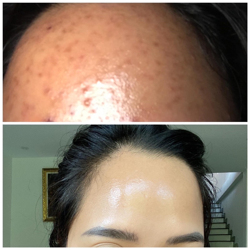 [Chính hãng] Mẫu mới 2021 Toner giúp làm sạch sâu và se khít lỗ chân lông NeoStrata Clarify Oily Skin Solution AHA 8%