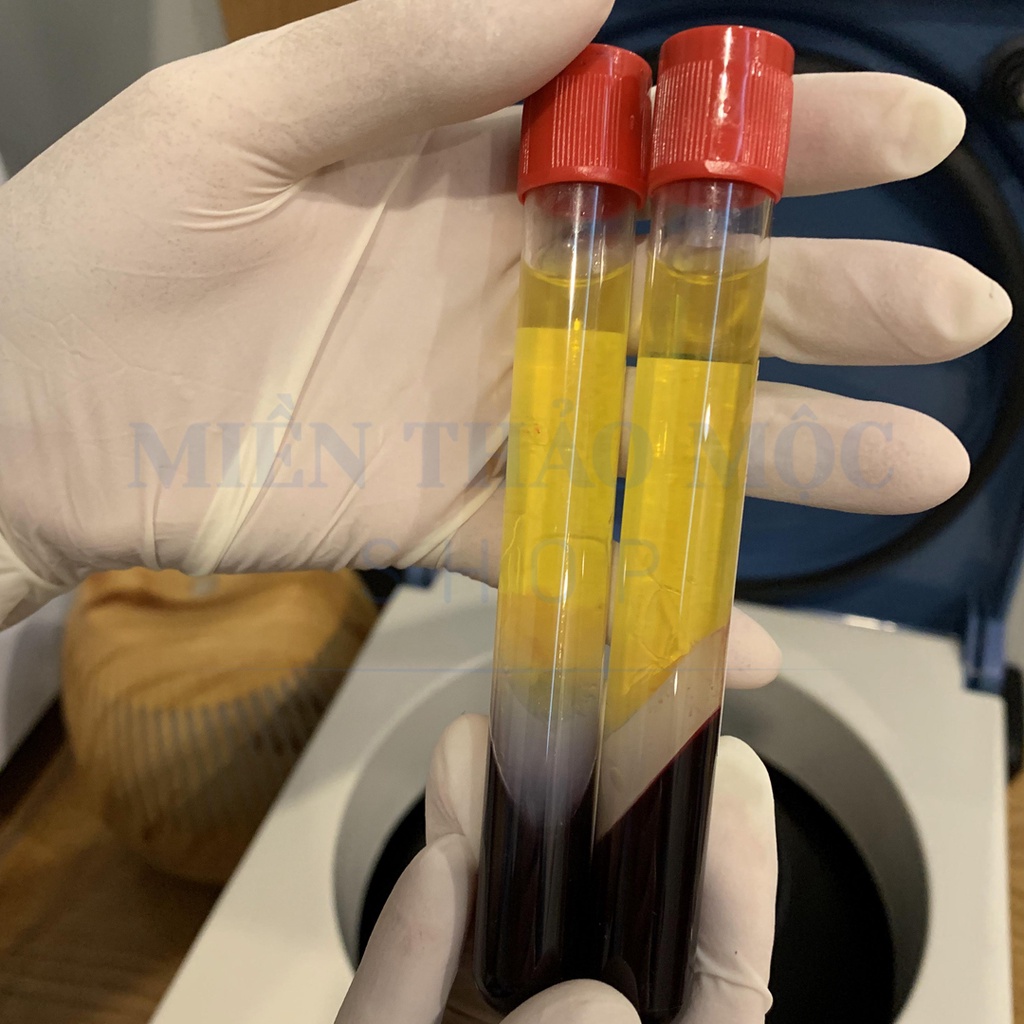 Bộ KIT PRP Pro 4.0 có hoạt hoá - Hỗ trợ chuyên môn và Hướng dẫn hoạt hóa miễn phí