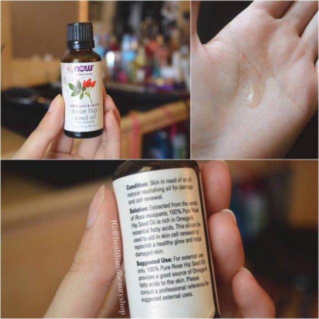 Dầu nụ tầm xuân Now Rosehip Seed Oil 30ml | BigBuy360 - bigbuy360.vn