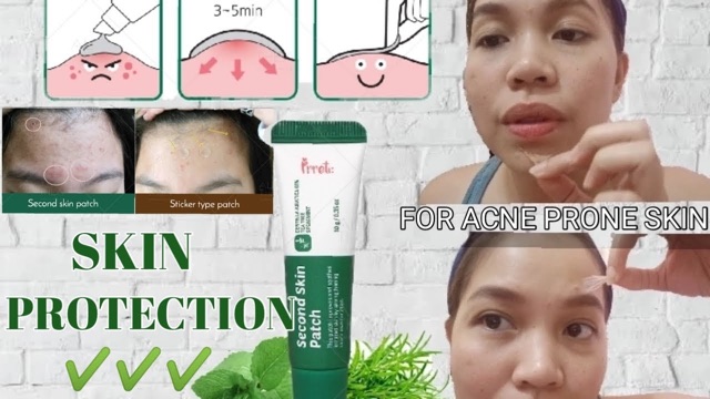 Gel che mụn Prreti 🍃 | BigBuy360 - bigbuy360.vn