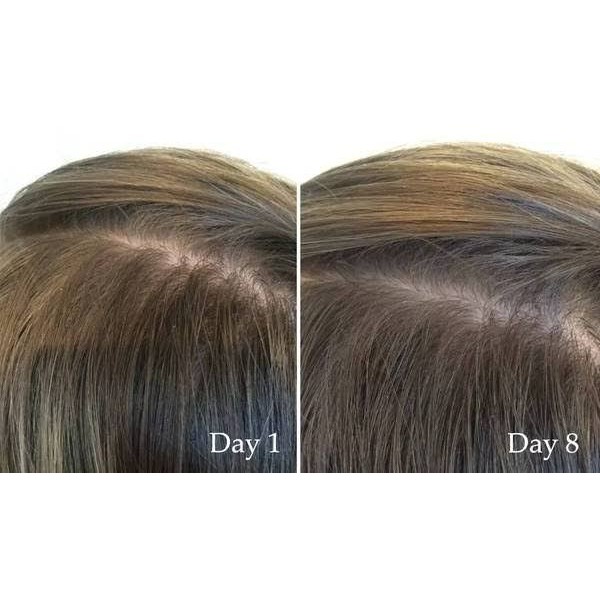 THE ORDINARY - Serum dưỡng mọc tóc  MULTI-PEPTIDE SERUM FOR HAIR DENSITY