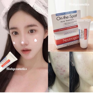 Kem cải thiện Mụn Neutrogena On The Spot Acne Treatment