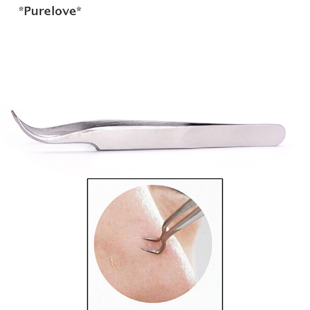 Kẹp Cong Lấy Mụn Đầu Đen Làm Sạch Da Mặt Tiện Lợi