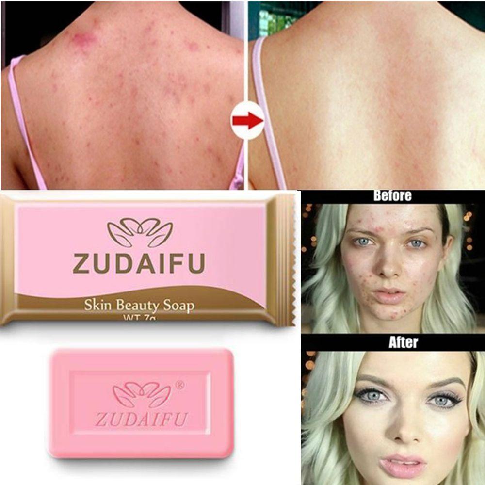 Xà Phòng Rửa Mặt 7g Dưỡng Ẩm Chống Nắng Kiểm Soát Dầu Kháng Khuẩn