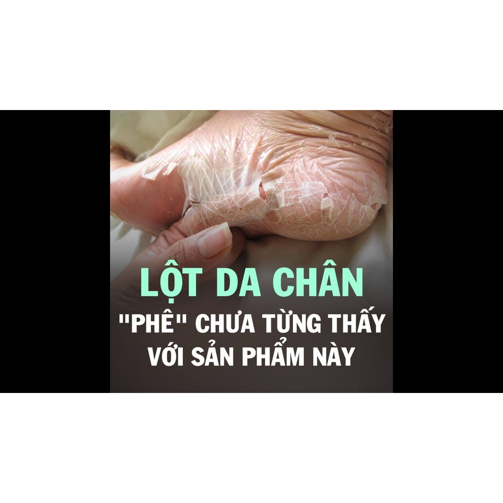 túi ủ lột da chết, chai sần Hàn Quốc Tiddy Footmask | BigBuy360 - bigbuy360.vn