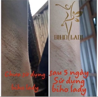 BIHO LADI [COMBO 2 HỘP] SIÊU DƯỠNG THÂM 5S (Biho Lady loại bỏ thâm hôi nách bẹn mông bikini )