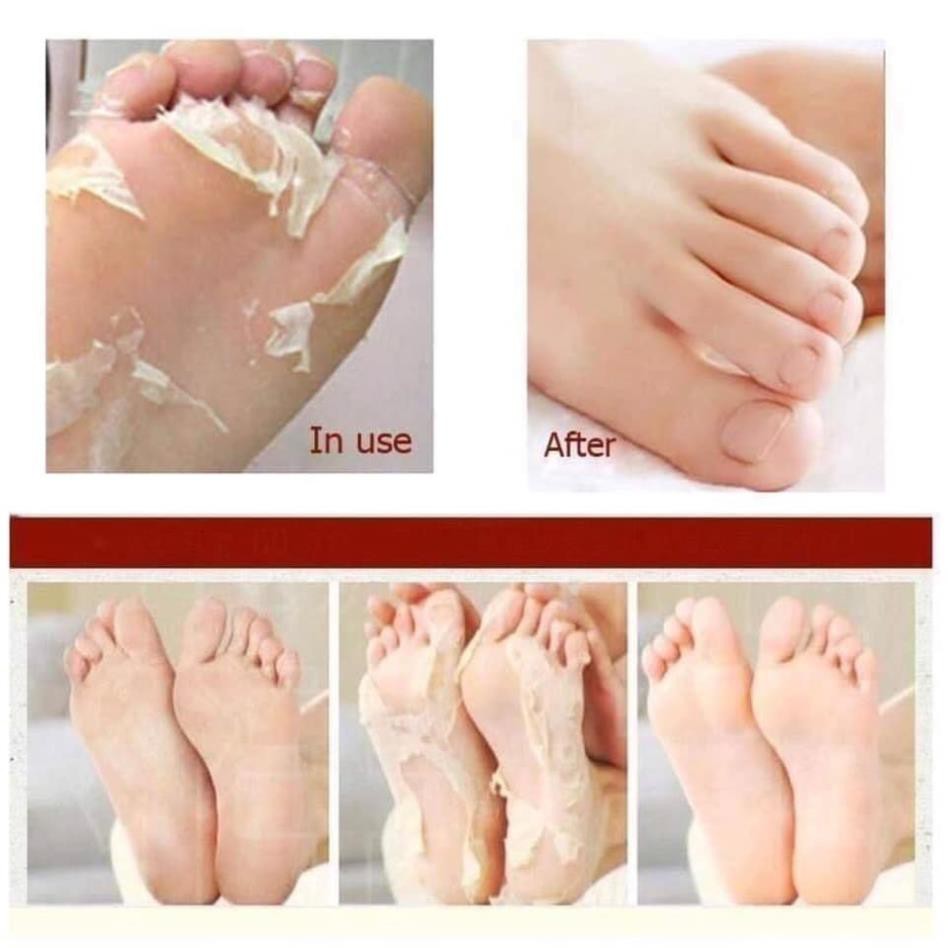 Túi ủ chân TẨY TẾ BÀO CHẾT DA CHÂN Lavender Foot Care Pack To Plan Giảm Chai, Sần, Giúp Mịn Da .