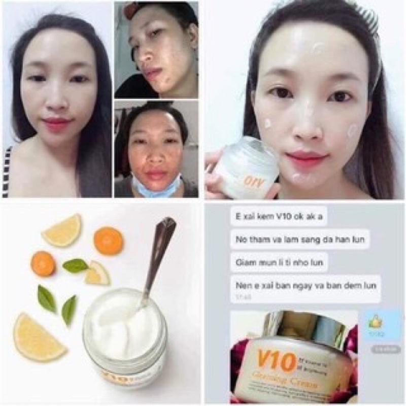 Kem V10 Skinaz Hàn Quốc Chính Hãng 100ml - V10 Gleaming Cream + Quà Tặng