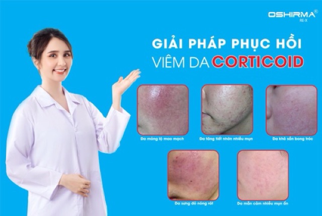 COMBO PHỤC HỒI DA MỎNG ĐỎ-DA NHIỄM CORTICOID OSHIRMA RE X