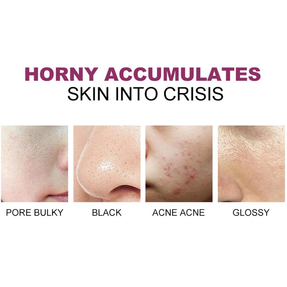 [Hàng mới về] Kem RtopR dưỡng ẩm giúp tẩy da chết cao cấp chuyên dụng