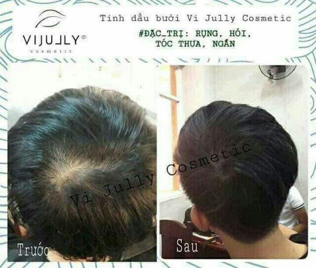 [Tặng Cột Tóc] Tinh Dầu Bưởi Xịt Bưởi Ngăn Ngừa Rụng Tóc Mọc Tóc | BigBuy360 - bigbuy360.vn