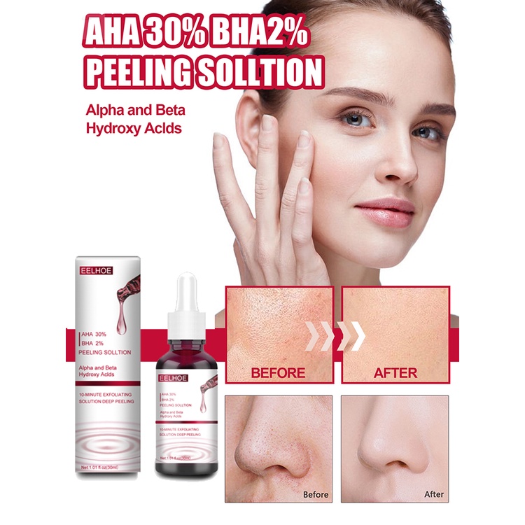 Tinh Chất Axit Hyaluronic 30% + BHA 2% Axit Salicylic Giúp Hỗ trợ giảm mụn Hiệu Quả