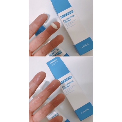 Kem se cồi mụn Claheal chuẩn Hàn | BigBuy360 - bigbuy360.vn