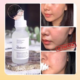 Serum cấp ẩm phục hồi da HA 2%+ B5