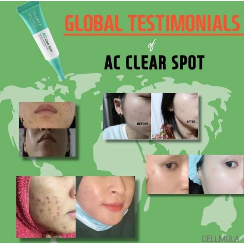 [CHÍNH HÃNG] Kem Chấm Mụn Cellmula Ac Clear Spot