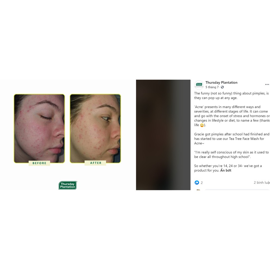 Sữa rửa mặt ngừa mụn Thursday Plantation Tea Tree Acne Face Wash 150ml