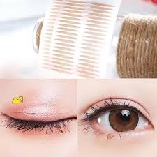 Kích mí dạng lưới